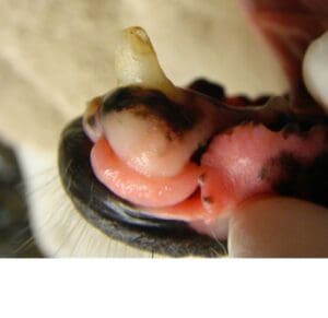 peripheral odontogenic fibroma