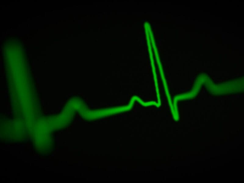 black screen displaying green heart rate