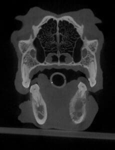 signs of infected teeth in dogs